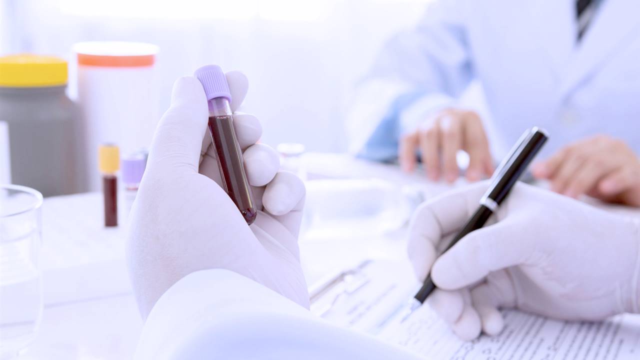 Billirrubina alta: Conoce sus causas y detección